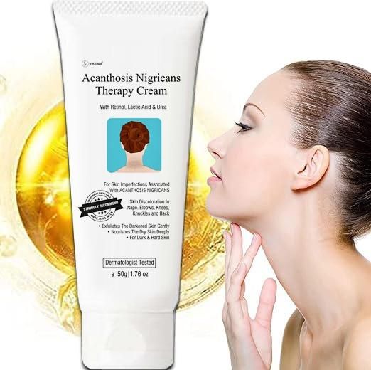Acanthosis Nigricans Therapy Cream 50g (Pack of 2)
